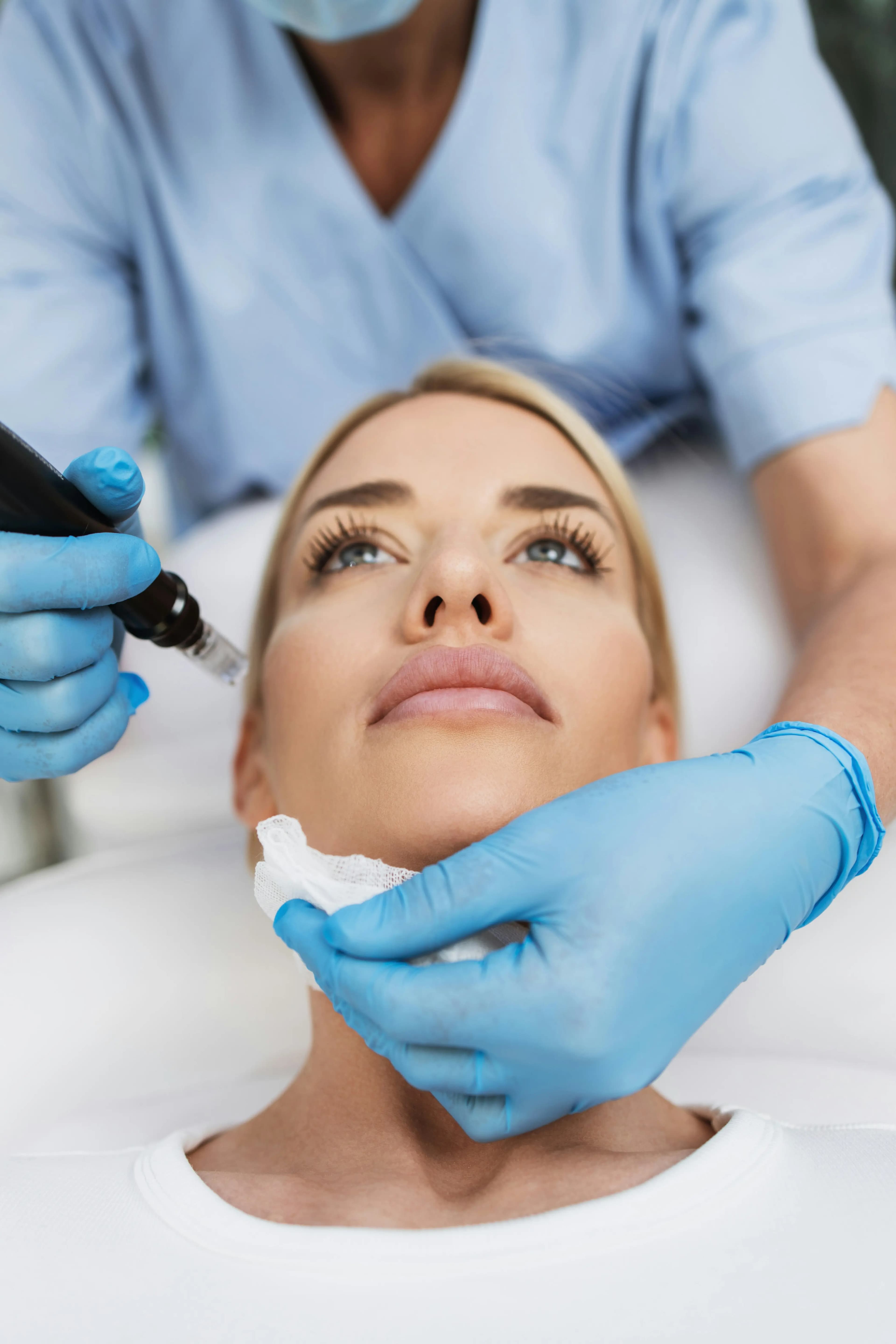 Microneedling Treatment